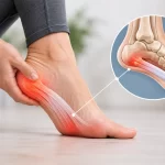 Topuğunu eliyle tutan kişi; ayak tabanında topuktan parmaklara uzanan plantar fasya ve topuktaki ağrı bölgesi işaretli, yanında topuk kemiği anatomisi